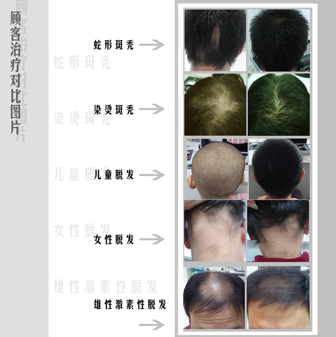 再出发