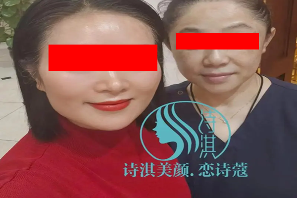 诗淇美颜祛斑