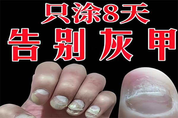 佐尔瑞甲清