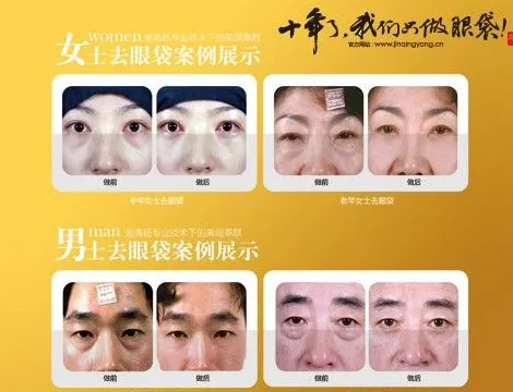 金清杨美容院