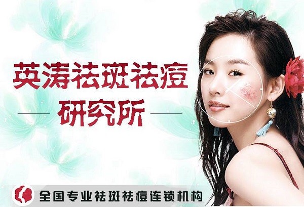 英涛祛斑