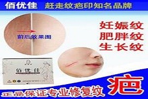 佰优佳
